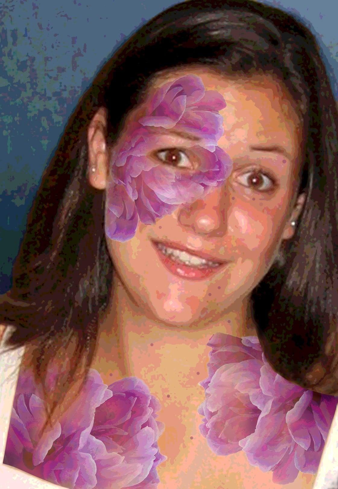 Robin Botie of ithaca, New York, photoshops purple bruises big as peonies on her daughter who died of leukemia.